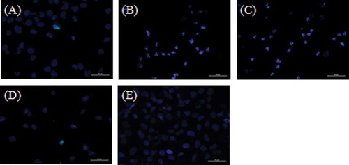 Figure 1. Representative fluorescence microscopy images of human proximal tubule cells (HK-2): (A) Control group, (B) Cis group, (C) Nec-1 + Cis group, (D) Cis + z-VAD group, and (E) Nec-1 + Cis + z-VAD group.