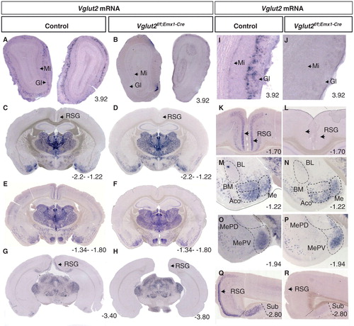 Figure 1. Specific deletion of Vglut2 in selected forebrain target areas. Floating in situ hybridization on coronal brain (70 μm) sections from control mice and Vglut2f/f;Emx1-Cre cKO mice (A–H) using a DIG-labelled Vglut2 probe. Close-ups as indicated in I–R, which demonstrate that cells expressing Vglut2 mRNA was absent in the mitral cell (Mi) layer and GI layer in the olfactory bulb (I–J). Vglut2 mRNA was also absent in the RSG of the medial cortex in the Vglut2f/f;Emx1-Cre mice (K, L). There is a loss of Vglut2 mRNA in the BMA, in the ACo the mRNA is partially deleted, and the Me amygdala and MePV are unaltered in the Vglut2f/f;Emx1-Cre mice (M–P). Vglut2 mRNA positive cells were present in the Sub in control mice but not in Vglut2f/f;Emx1-Cre cKO mice (Q, R). ACo = anterior cortical amygdaloid area; BL = basolateral amygdaloid nucleus; BM = basomedial amygdaloid nucleus anterior part; cKO = conditional knock-out; DIG = digoxigenin; GI = periglomerular layer; Me = medial amygdaloid nucleus; MePV = posteriorventral medial amygdaloid nucleus; Mi = mitral cell layer; RSG = retrosplenial group; Sub = subiculum; Bregma interval (dorsal, ventral) is shown in lower right corner.