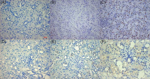 Figure 3.  Immunohistochemical staining of Cleaved caspase-3 and Bax in kidney tissue at 24 h after reperfusion. (A–C) Cleaved caspase-3 located mainly in nucleus of renal tubular epithelial cells. (D–F) Bax existed mainly in cytoplasm of renal tubular epithelial cells. (A) and (D); Control group, (B) and (E); I/R + NGAL group, (C) and (F); I/R + NS group. Original magnification, ×400. Scale bars: 20 μm.