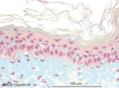 Figure 5.  Skin histological aspect at 2 min after a 20-sec exposure to 30 µL of 70% hydrofluoric acid (HF). The skin showed four to five cellular layers with definitely abnormal morphology: cells with nuclei becoming pyknotic, especially in the higher epidermal layers, and the cytoplasm becoming acidophilic as reflected by orange keratinocyte pigmentation. The cellular structures in the dermis showed normal morphology.