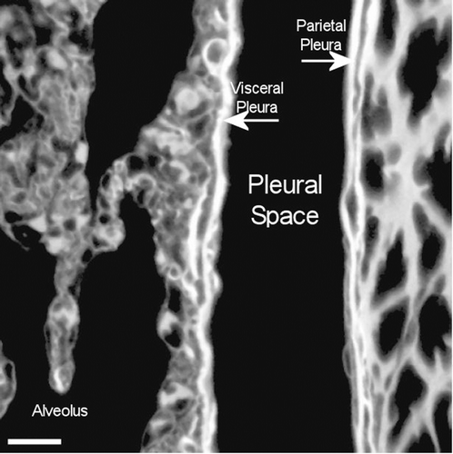 Figure 14.  View of the pleural space at 272 days postexposure from a control animal is shown in the confocal image. The subpleural alveolar septa is seen on the left with the parietal pleura shown on the right. The brighter white is indicative of collagen in the visceral and parietal pleural walls.