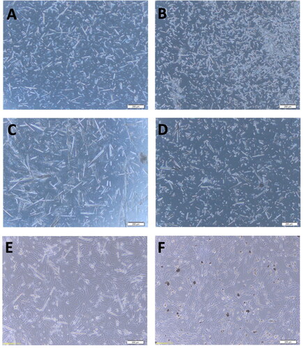Figure 1. The PNT morphology under a 100× microscope. (A) L-PNT before DNA binding; (B) S-PNT before DNA binding; (C) L-PNT binding with DNA vaccine; (D) S-PNT binding with DNA vaccine; (E) L-PNT co-culture with BHK-21 cells, for 48 hr; (F) S-PNT co-culture with BHK-21 cells, for 48 hr. The scale bar shows 200 µm.