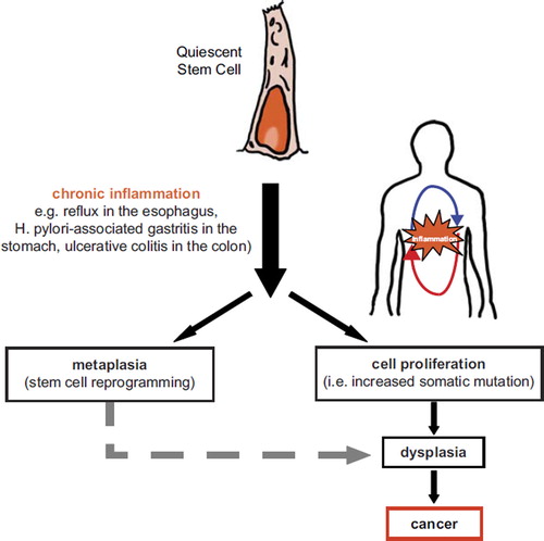 Figure 2. Hypothetical model for the quiescent stem cell origin of inflammation-associated cancers.