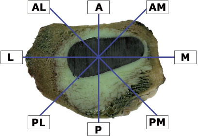 Figure 5. The nucleator with 8 intercepts defining 8 regions of interest (ROIs) on the cross section of the left femur. AL: anterior-lateral; A: anterior; AM: anterior-medial; M: medial; PM: posterior-medial; P: posterior; PL: posterior-lateral; L: lateral.