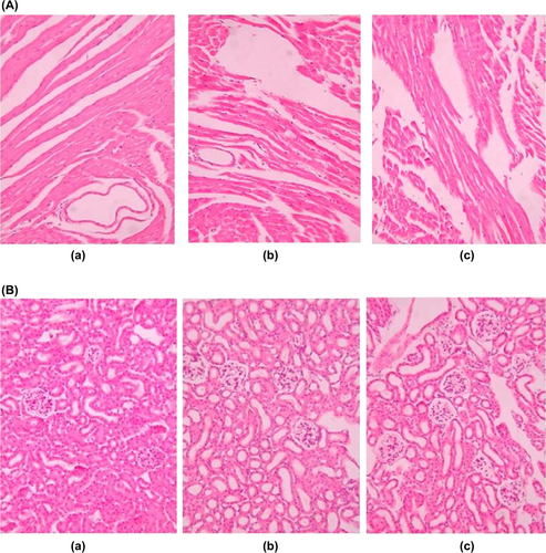 Figure 5. Tissue sections isolated on 48 h after treatment and stained with hematoxylin and eosin for histopathological evaluation. (A) Liver. (B) Spleen (× 200). (a) PTX injection. (b) PTX conventional liposomes and (c) PTX-loaded stealth liposomes.