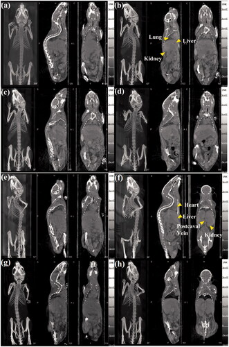 Figure 5. Micro-CT images of a mouse lung, liver, and kidneys (a) before and at (b) 0.5 h, (c) 1 h, and (d) 2 h post intravenous injection of Au-Ac-PENPs. Micro-CT images of a mouse heart, liver, kidneys and postcaval vein (e) before and at (f) 0.5 h, (g) 1 h, and (h) 2 h post intravenous injection of Au-Gly-PENPs.