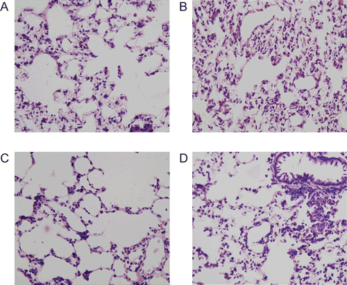 Figure 4.  Representative photomicrographs [hematoxylin and eosin (H&E) stain; 400×] of lung from rats with different treatments are shown: A: sham group; B: control group; C: Da-Cheng-Qi decoction (DCQD) (15 g/kg) treatment group; and D: DCQD (7.5 g/kg) treatment group.
