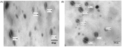 Figure 2. Transmission electron microscopy images of (A) B-NLC-45; (B) ARM + LUM NLC-45.