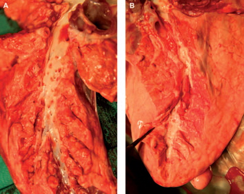Figure 3. After lung evaluation the pulmonary arterial branches were macroscopically studied for thrombotic material by opening the arteries as far distally as possible. No thrombotic material was observed in neither of the groups. Figure 2A shows a pulmonary graft not treated with heparin, and Figure 2B a pulmonary graft treated with heparin.