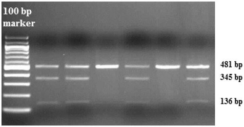 Figure 1. Genotyping for the GAS6 gene polymorphism. Representative gel showing the genotype for GAS6 834 + 7G/A. The first lane is for 100 bp DNA ladder.