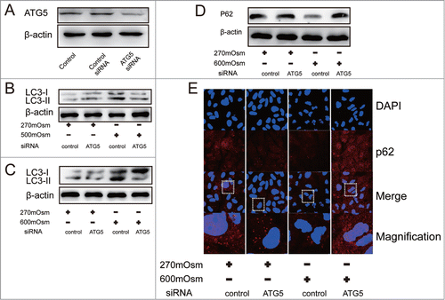 Figure 5. Inhibition of autophagy by ATG5 siRNA. Typical images and bands are shown. (A) Western blotting analysis for ATG5 in cells after transfection with ATG5 or control siRNA. (B, C) Western blotting analysis for LC3 in cells treated with normal medium or hyperosmotic medium combined with ATG5 siRNA or control siRNA. (D, E) Western blotting and immunofluorescence analysis for SQSTM1/P62 in cells treated with normal medium or hyperosmotic medium combined with ATG5 siRNA or control siRNA. (magnification × 400).