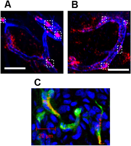 Figure 7. IVCLSM analysis of PICsomes in the tumor vasculature. Blood vessels were pre-stained (blue) with anti-CD31 (PECAM-1) antibodies, and tumor vasculature snapshots were then taken (A) 6 h and (B) 24 h after the administration of 40%-cRGD-PICsomes (red). Scale bar = 100 μm in all images. Co-localizations of blood vessels (blue) and 40%-cRGD-PICsomes (red) in the region selected (indicated by a white rectangle in figures 7(A) and (B)). (C) Confocal laser scanning microscopy (CLMS) analysis of a tumor section. The tumor was harvested 3 h after injection of 40%-cRGD-PICsomes (red). The vasculature was stained with PECAM-1 (green), and nuclei were stained using Hoechst 33342 (blue). Scale bar = 20 μm.