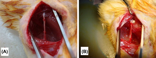 Figure 3. Surgical implantation of autograft (A) and aligned PHBV graft (B) for nerve regeneration in rat sciatic nerve under a microscope (10×).