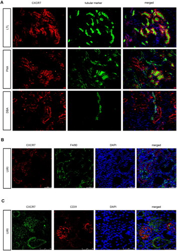 Figure 2. CXCR7 Is expressed mainly in renal tubule epithelial cells.(A) Images of CXCR7 and various segment-specific tubular marker colocalization in the kidneys of sham mice. Frozen kidney sections (3 μm) were collected from the sham mice. CXCR7 (red) and three segment-specific tubular markers (green), namely, lotus tetragonolobus lectin (LTL), peanut agglutinin (PNA), and dolichos biflorus agglutinin (DBA), were detected by immunofluorescence. Scale bar, 50 μm. (B) Immunofluorescence staining for CXCR7 (red) and F4/80 (green) and DAPI staining were performed on the kidneys of UIRI mice. Scale bar, 50 μm. (C) Immunofluorescence staining of CXCR7 (green) and CD31 (red) was performed, and immunofluorescence was used to detect DAPI in the kidneys of the UIRI model mice. Scale bar, 50 μm.