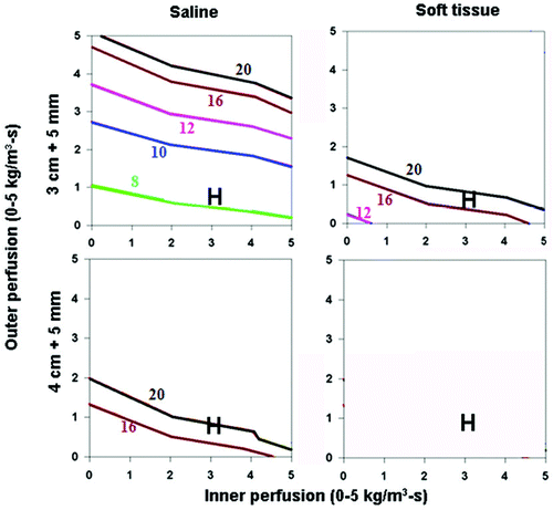 Figure 5. Effect of varying inner tissue electrical conductivity on RF heating for a 3 cm single electrode. This figure demonstrates the differences in the time required to achieve 50°C, using an internally cooled 3 cm single electrode, of both 3 (top) and 4 (bottom) cm tumors including a 5 mm ablative margin, infused with adjuvant saline (left, 4.0 S/m) or surrounded by soft tissue (right, 0.5 S/m), for varying inner tumor (y-axis) and outer tissue (x-axis) perfusions. Increasing the inner tissue electrical conductivity (adjuvant saline > soft tissue) decreases the time required to achieve ablation of the tumor alone from 12–20 min to up to 8 min, and increases the range of inner/outer perfusions at which tumors can be completely ablated. As an example, in hepatocellular carcinoma, with representative inner/outer perfusion characteristics (hypervascular HCC with an inner perfusion of 3.3 kg/m3-s, surrounded by cirrhotic liver with an outer perfusion of 1 kg/m3-s) denoted by the ‘H’, the outer thermal conductivity clearly influences the time required to achieve ablation, if this can be achieved at all.