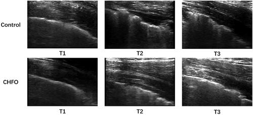 Figure 2. Comparison of lung ultrasound clips.