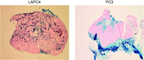 Figure 3. Representative tumour sections harvested from mice stained with Perl’s reagent (Prussian blue) highlighting iron oxide (magnetic iron oxide) distribution.