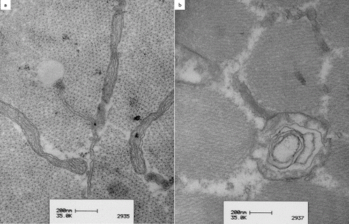Figure 2. Transmission electron microscopy of the vastus lateralis muscle in patient 2, a five-year-old Quarter horse stallion: note extremely long and slender mitochondria with longitudinal cristae (a). Some mitochondria show an onion-shaped aspect on transverse section due to cristae forming concentric lamellae (b).