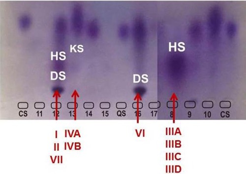 Figure 3 Electrophoresis of urinary GAGs.