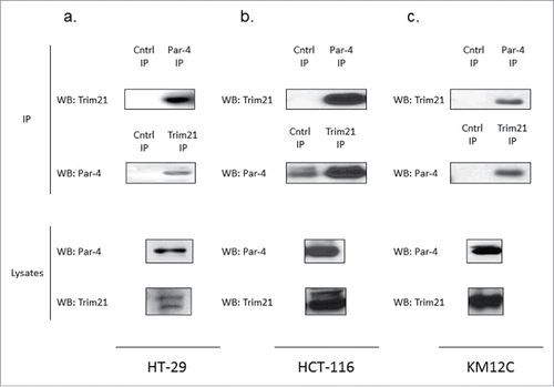 Figure 1. TRIM21 is a novel interacting partner of Par-4. HCT-116, HT-29, and KM12C cells were grown and transfected with either Par-4 expression plasmid or control plasmid for 48 hrs. Co-immunoprecipitations were performed in HT-29, HCT-116, and KM12C cells (a, b, c, respectively) in order to validate the TRIM21/Par-4 interaction.
