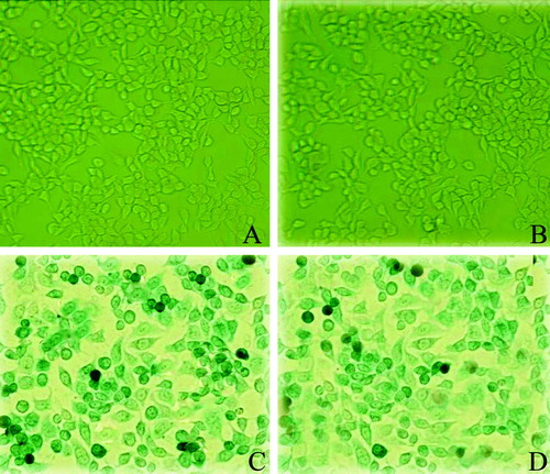 Figure 2.  The efficacy of transfection of the constructed adenovirus vector in cultured cells. The transfection efficacy of the adenovirus vectors was demonstrated with Adv-LacZ using the β-galactosidase staining. A: untransfected capan-2 cells. B: untransfected A549 cells. C: Adv-LacZ transfected capan-2 cells. D: Adv-LacZ transfected A549 cells. The cells showed positive β-galactosidase staining were visualized under microscope (x 200) and nearly 100% transfection was shown when MOI was up to 100. Untransfected cells showed negative β-galactosidase staining.