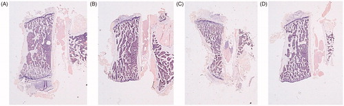 Figure 10. Hematoxylin-eosin staining 4×. Trabecular component of the L4 vertebrae. Sham-operated rats (SHAM) (A) and orchidectomized rats (ORX) (B) as baseline and castrated rats treated with 10 mg/kg of OPG–Fc twice weekly (ORX + OPG–Fc) (C) or testosterone cypionate (1.7 mg/kg/once a week) (ORX + testosterone) (D).