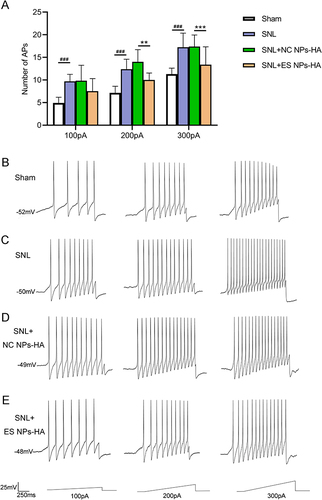 Figure 6 Effect of ES NPs-HA on the excitability of DRG neurons in SNL mice. The number of Aps in DRG neurons of mice receiving ES NPs-HA treatment was recorded, 5 days after SNL (A); The representative traces of action potentials in responding to 100, 200, and 300 pA ramp current stimulation (B–E). Sham (B); SNL (C); SNL+NC NPs-HA (D); SNL+ES NPs-HA (E). **P<0.01, ***P<0.001, vs SNL+NC Ps-HA; ###P<0.001, vs Sham. Two-way RM ANOVA followed by the Bonferroni test. Sham: Sham surgery group; SNL: Spinal nerve ligation group; SNL+NC NPs-HA: Injection of hydrogel-containing 0.9% saline-encapsulated nanoparticles after SNL; SNL+ES NPs-HA: Injection of hydrogel-containing esketamine-encapsulated nanoparticles after SNL.