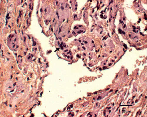 Figure 6. Dead cells by apoptosis stain were identified as those with a red-brown staining of the nucleus indicating the presence of nuclear DNA fragmentation (↑).