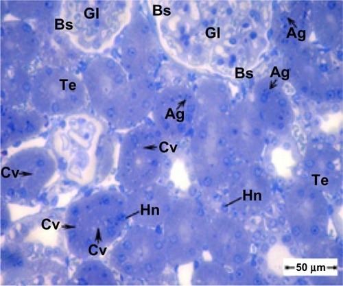 Figure 4 Semithin section of kidney tissue from the treatment group showing swollen tubular epithelium and cytoplasmic vacuolization. Note that the glomeruli show an increase in cellularity and obliteration of Bowman’s space. Scale bar 50 μm.Abbreviations: Ag, silver nanoparticles; Bs, Bowman’s space; Cv, cytoplasmic vacuolization; Gl, glomeruli; Hn, hypertrophied nuclei; Te, tubular epithelium.