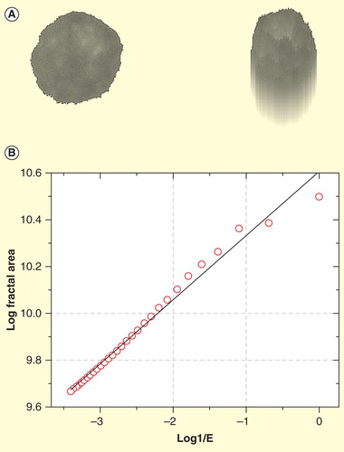 Figure 8. Estimation of the fractal dimension of a myeloma cell nucleus. (A) Myeloma cell nucleus after segmentation (left) and its pseudo 3D transformation (right). (B) The log-log-plot (also called log-log plot or log-log graph ) for the determination of the fractal dimension (FD) is estimated from the slope of the ideal regression line (black) obtained by curve fitting. X-axis shows the logarithms of the inverse values of the size of the structuring element and y axis the logarithmic values of the fractal areas. The fractal dimension (FD) is derived from the slope of the regression line.Scaling window: 200 nm–6.000 nm.