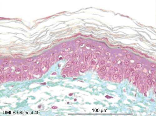 Figure 3.  Skin histological aspect after a 20-sec exposure to 30 µL of 70% hydrofluoric acid (HF). No deterioration of the epidermal or dermal structures.