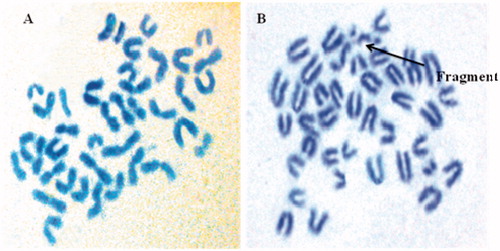 Figure 12. (A) Normal chromosomes in mice bone marrow cells. (B) Types of chromosomal aberrations in bone marrow cells of mice treated with cyclophosphamide.