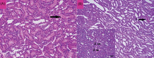 Figure 8. The histopathological examination of the renal tissue of mirtazapine + renal ischemia-reperfusion (MRIR) group. Mild swelling in tubular epithelial cells (A, Arrow) and mild hyaline cast accumulation (B, Arrow-1) were observed. Microvilli structures in proximal tubules were observed to be preserved (B, Arrow-2).
