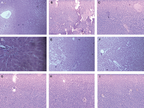Figure 2.  Photomicrographs of 15 day experimental rat liver. Section A (10×) shows a normal histological section with well arranged cells and clear large central vein, cytoplasm and nucleus are well preserved. Section B (10×) shows the complete destruction of hepatocytes degeneration of central vein, fatty degeneration, loss of cell structure and damage in cell membrane in STZ-induced diabetic rat liver. Sections C, D, and E (10×) are treated with PESA (100, 250 & 500 mg/kg) and shows slight necrosis and restored to normal, respectively. Picture F, G & H (10×) depicts no damage and the hepatocyte architecture is near to normal by treatment with α-amyrin acetate (25, 50 & 75 mg/kg). These depict the well preserved hepatocytes, clear cytoplasm and nucleus with less neutrophil infiltration. In case of standard glibenclamide (0.5 mg/kg), I (10×) treatment shows no damage in the hepatocytes and well arranged with central vein.