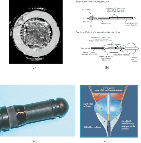 Figure 1. Transducers for interstitial applications: (a) Tip of a dual mode intracardiac ablation tool. The applicator consists in a 112-element imaging array surround by a coagulating ring (Courtesy of KL Gentry). (b) Multi-element cylindrical transducers for coagulation in prostate under MR guidance (Courtesy of CJ Diederich and WH Nau). (c) 64-element cylindrical array for treating oesophageal tumours. Plane waves are reconstructed and rotated electronically. (d) Intracardiac catheter producing focused coagulation around the pulmonary vein for treating atrial fibrilation (Courtesy of DA Smith, ProRhythm, Inc.).