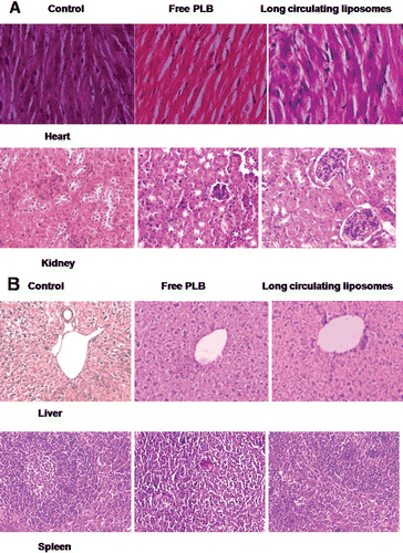 Figure 5.  Toxicity assessment of free PLB and long circulating liposomes (C1) in C57BL/6J mice. The histopathologic examination of tissue sections of (A) heart and kidney, (B) liver and spleen was made after mice were sacrificed and staining with H&E stain. All the treatment groups showed no signs of toxic pathological change; magnification 400X; 100X for liver.