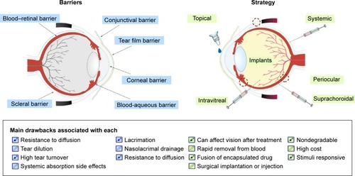 Figure 1 Barriers and strategy of administration for delivering different types of formulations to the inner eye.