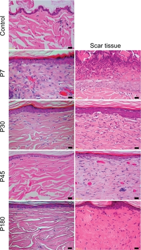 Figure 3 The histology of control, near-infrared (NIR) irradiated tissues, and scar tissues with hematoxylin and eosin staining (×400 magnification). The left column shows control skin and NIR irradiated skin, and the right column shows scar tissues. Images from top to bottom show control, P7, P30, P45, and P180. Scale bar =20.0 μm.