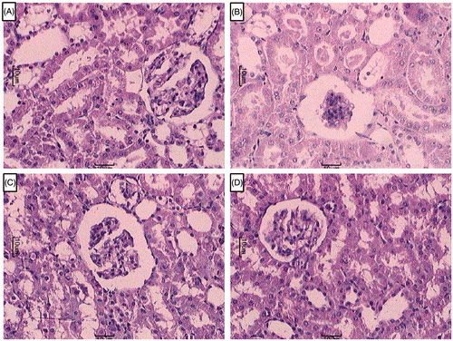 Figure 4. Effect of berberine on RIR induced alteration in kidney histology. Photomicrograph of sections of kidney of (A) normal, (B) RIR control rats, (C) Berberine (20 mg/kg) treated rats, and (D) Berberine (40 mg/kg) treated rats. H & E staining at 100×.