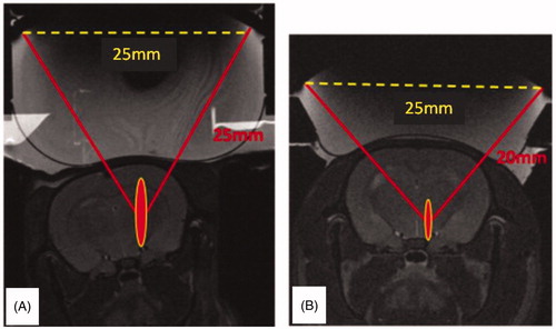 Figure 2. T2 weighted images of the transducers on top of the rat head with the position and predicted extent of the corresponding focal spots. (A) Single element F/D = 1. (B) Single element F/D = 0.8.