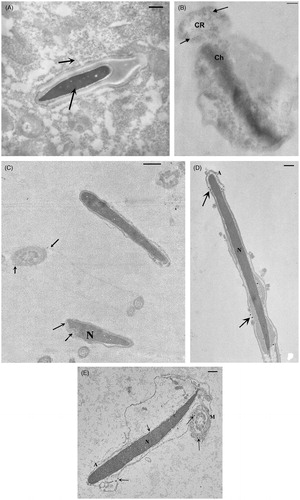 Figure 1. Transmission electron microscopy (TEM) images of rabbit testicular tissue and ejaculated sperm (day 21 from nanoparticles (NPs) injection). A) Particles were evident in testicular tissue (arrows) and inside the cytoplasm of Sertoli cell and into the normal nucleus of an elongated spermatid. B–E) In ejaculated sperm, aggregates of NPs (arrows) were inside the cytoplasmic residue (B) and the sections of nuclei and axoneme (C). Sometimes NPs were localized in the acrosome that appeared broken and partially reacted (D) or swollen (E) and inside the mitochondria (E). A: acrosome; N: nucleus; Ch: chromatin; CR: cytoplasmic residue; M: mitochondria. A, C) Bar 1 µm; B, D, E) Bar 300 nm.