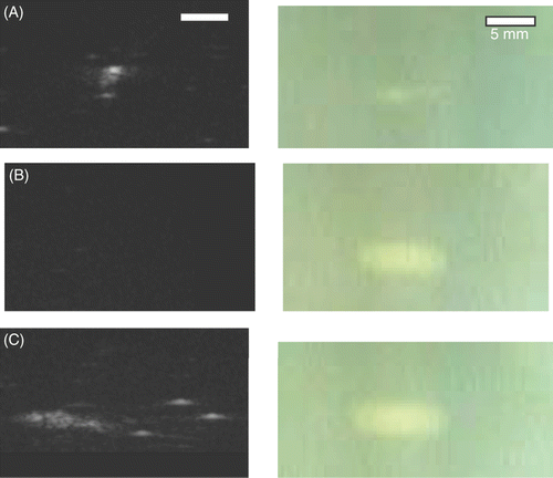 Figure 5. Ultrasonic (left) and optical (right) images of lesions formed by ablations using (A) 1 MHz for 60 s, (B) 3.2 MHz for 60 s, and (C) 1 MHz for 30 s followed by 3.2 MHz for another 60 s (all at 70 W). The ultrasonic image in (C) was shifted left to reveal the few large bubbles to the right of the bubble cloud.