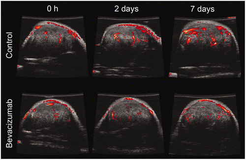 Figure 1. Power Doppler ultrasound images of tumours treated with saline (control) and bevacizumab at 0 h, 2 days, and 7 days after administration. Representative images are shown at a similar location for the same tumour with B-mode images (greyscale) overlaid with power Doppler (red). Doppler signal above an arbitrary threshold is only shown for clarity. Power Doppler images represent a relative tumour blood flow.