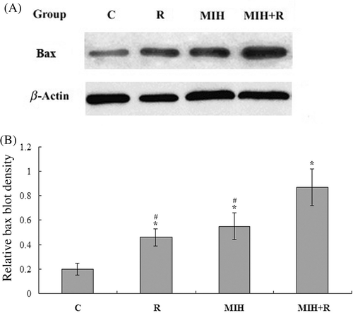 Figure 3. Western blot analysis of Bax expression in the primary tumour. (A) 25 days after the treatments, primary tumour tissue lysates from nine mice in each treatment group were subject to western blot analysis for Bax expression. β-actin blotting was used as a loading control. Representative results are shown in this figure. (B) Bax and β-actin blots were measured by densitometry. The density of the Bax blot was normalised against that of β-actin to obtain a relative Bax blot density. Treatment groups: C, tumour-bearing control; R, radiotherapy; MIH, magnetic induction hyperthermia; MIH + R, magnetic induction hyperthermia plus radiotherapy. *P < 0.05 compared with group C; #P < 0.05 compared with group MIH + R.