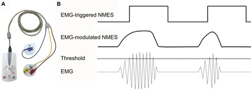Figure 7 (A) The IVES+ system (OG Wellness Technologies Co., Ltd.) that is currently used in Fujita Health University Nanakuri Memorial Hospital. (B) EMG-triggered and EMG-modulated modes can be used for this device. In the former mode, NMES is applied with a constant current intensity for a fixed time when an EMG that exceeds a predefined threshold is detected. In the latter mode, the intensity of the stimulation current is proportional to the amplitude of EMG.