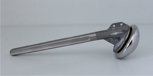 Figure 4. A modular stemmed hemiarthroplasty with the head connected to the stem by a taper locking system with the possibility of different head-stem combinations depending on the size of humerus.