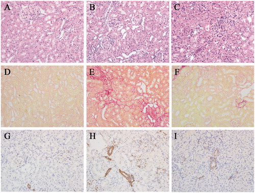 Figure 2. Picroside II attenuated tissue damage, fibrogenic development and α-SMA expression during I/R. (A, D, G) section from sham-operated rat, (B, E, H) section from rat subjected to I/R, (C, F, I) section from rat subjected to the treatment with Picroside II. (A–C) H&E staining. (D–F) Sirius red staining. (G–I) α-SMA immunohistochemical staining. All H&E, Sirius red and immunohistochemical staining, original magnification ×200.