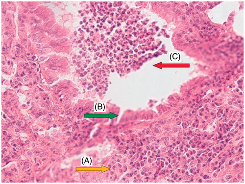 Figure 3. CP (200 mg/kg) group: a section of mouse lung showing hyperplastic pneumocytes (A, yellow arrow), respiratory type epithelium (B, green arrow), large distal air spaces filled by lymphocytes, neutrophils, and cell debris (C, red arrow). (Hematoxylin and eosin-stained paraffin sections; H&E × 400.)