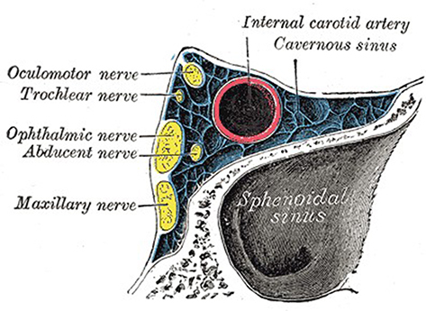 Figure 2 Coronal view of the cavernous sinus including its own contents and the adjacent sphenoidal sinus. This diagram has been reproduced from Gray’s Anatomy 20th US edition which has now lapsed into the public domain.