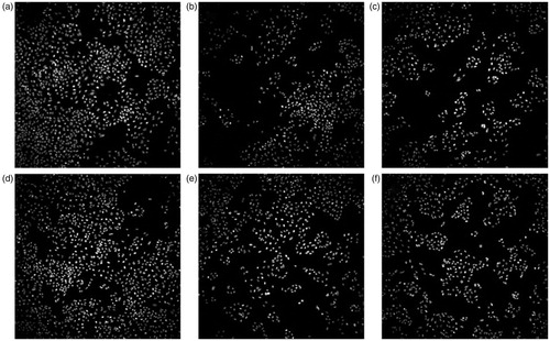 Figure 5. Nuclei-stained A549 cells exposed to MWCNTs for in vitro toxicity experiments using HCI. After incubation for 48 h with the corresponding controls or MWCNTs, cells were fixed, stained with Hoechst and imaged using INCell Analyzer. Negative control (A), solvent control for 0.2 mg/mL (B), solvent control for 1.0 mg/mL (C), PSb stock at 200 µg/mL. (D), PSa stock at 40 µg/mL concentration (E), VSc stock at 40 µg/mL concentration (F).